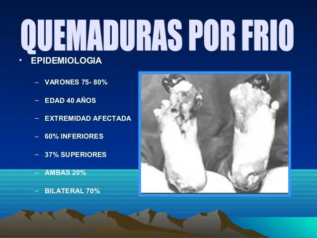 por frio