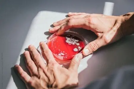 si eres gay manten asi tu salud sexual
