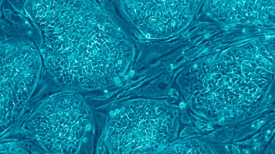 Esperanzadora investigación contra el cáncer.