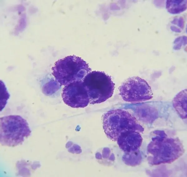 alergia