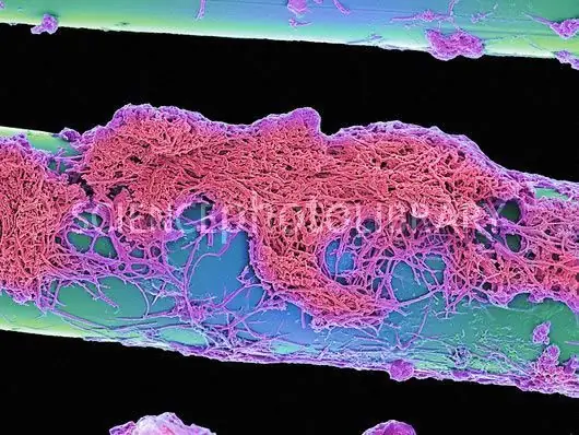 microscopio