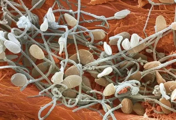 cosas comunes que dan miedo bajo el microscopio