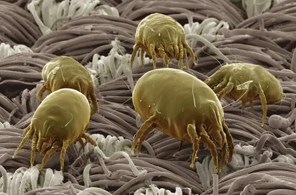 cosas comunes que dan miedo bajo el microscopio