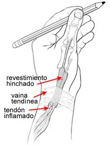 salud