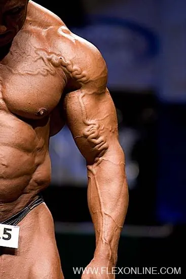 10 enfermedades que tu cuerpo podría estar manifestándote