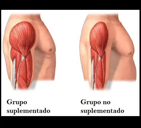 Problema en riñones y Bicarbonato de Sodio (Mi experiencia)