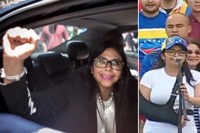 Canciller Vnzlna aparecio con el brazo enyesado!