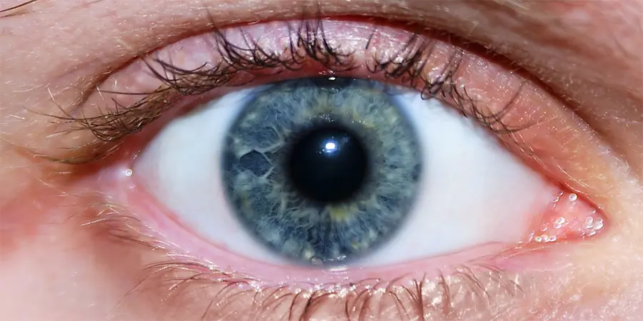 Detectan alzheimer y esquizofrenia por movimiento de ojos