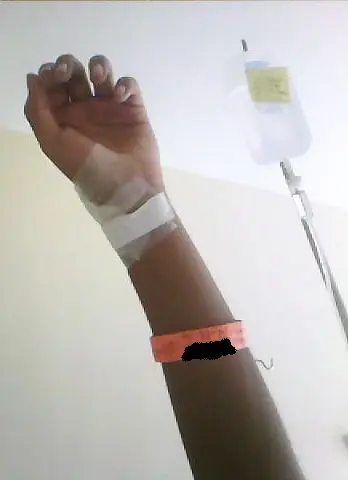 Me operaron de fimosis y te lo cuento.