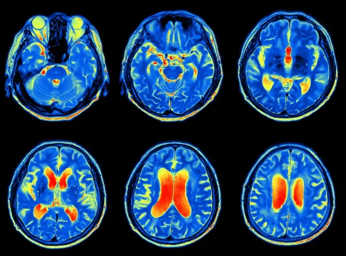 El cerebro desarrolla nuevas estrategias cuando envejece