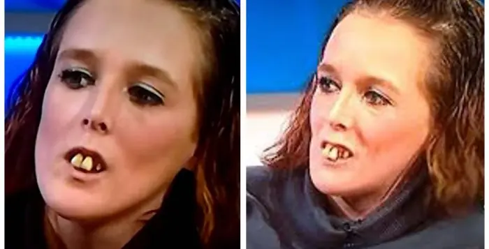 La apodaron “la chica de los dientes” y se burlaban de ella.