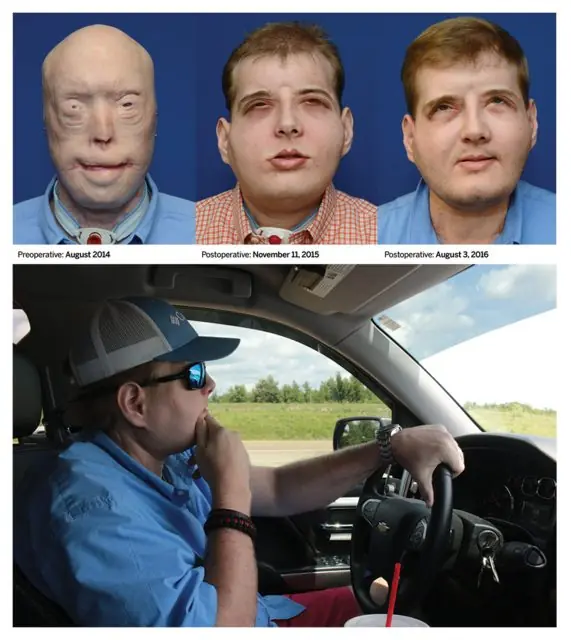 prueban