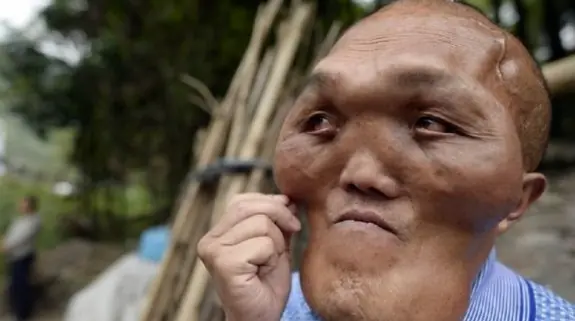 Terrible historia, chino apodado cara de alien
