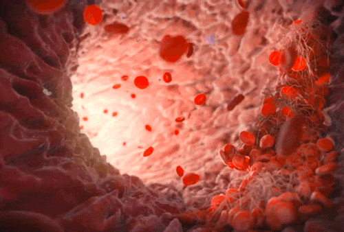 La sangre en gif e imagenes
