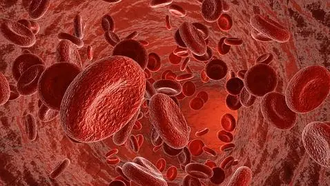 cardiovascular