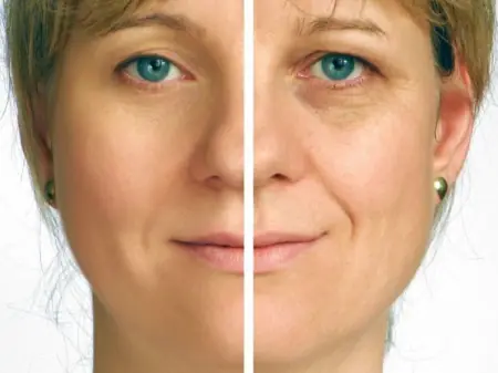 Rejuvenece tu piel varios años con estos simple remedio case
