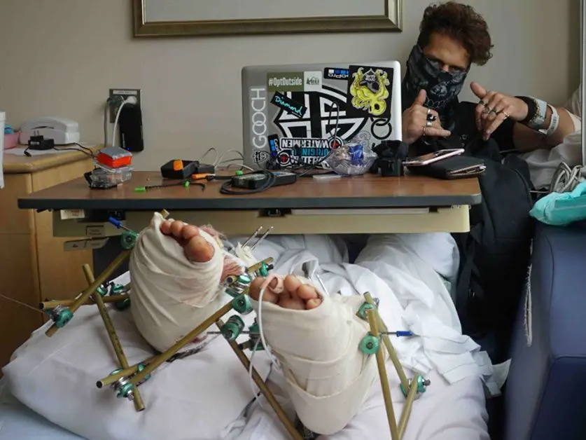 Youtuber accidentado