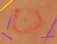 marca de la bestia o de clavos de jesus?