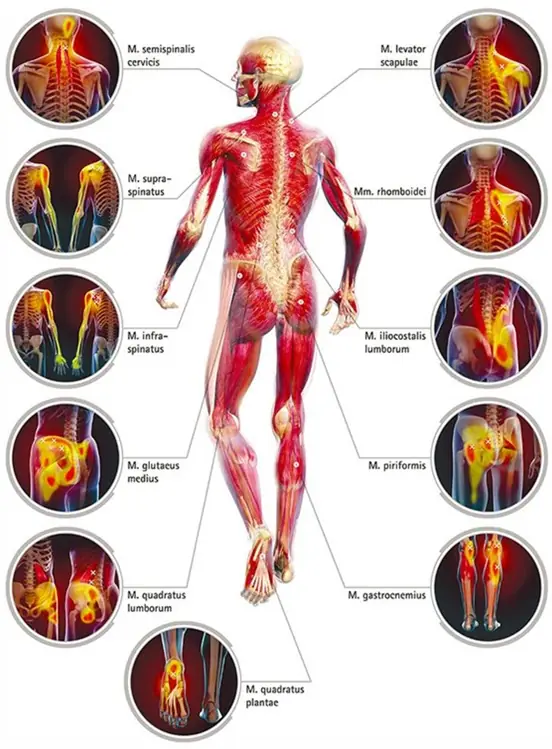 musculo esqueletico