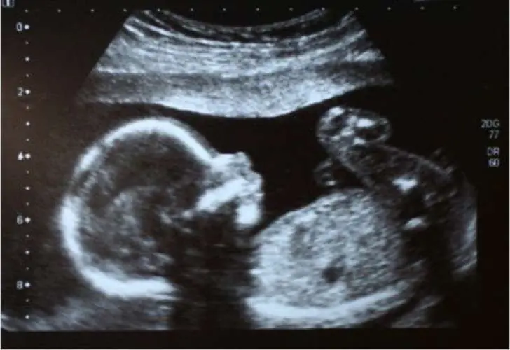 ABORTA