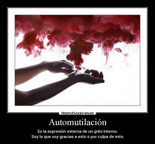 Autolesión: Definicion, Causas, Factores de Riesgo.