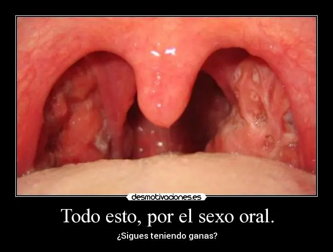 boca