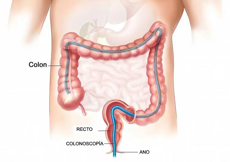 bajos ingresos