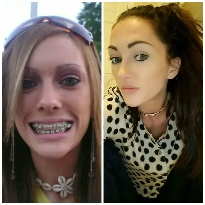 transformacion