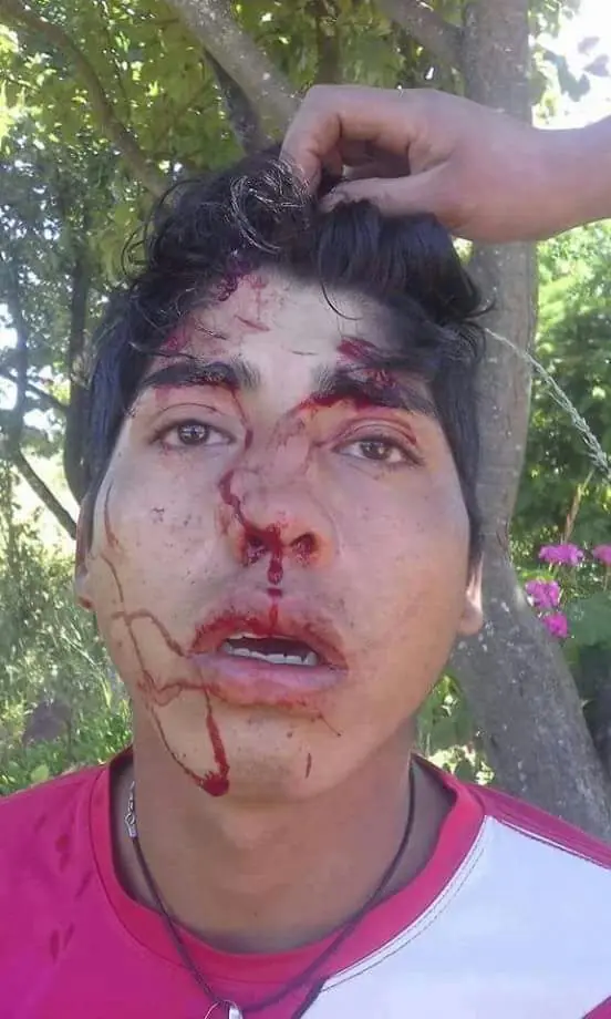 represion