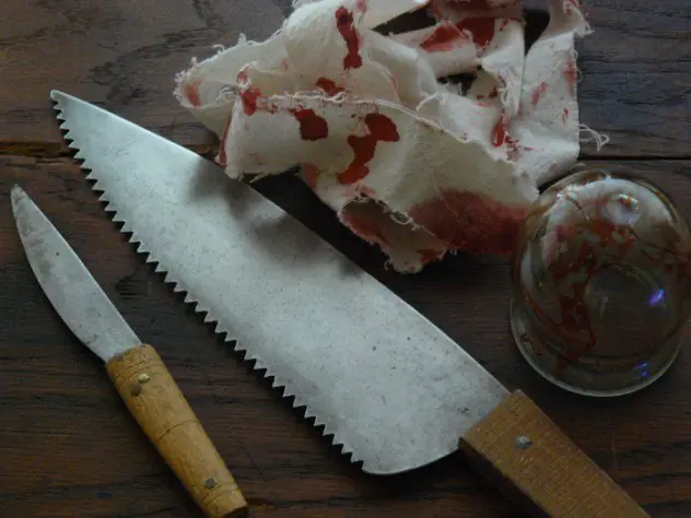 10 prácticas médicas medievales raras