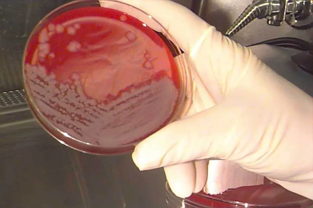 Bioterrorismo