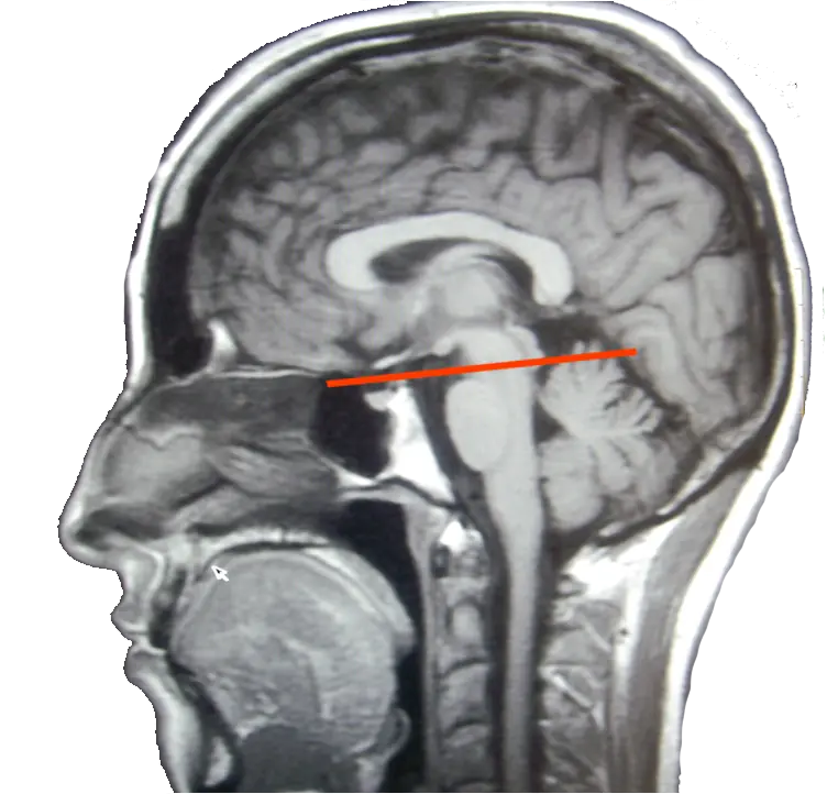 Neurologia