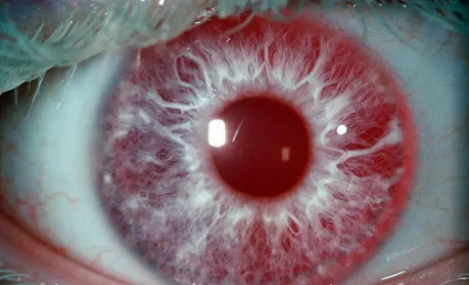 Ojos Ojos