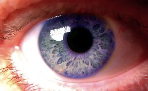 Los 8 colores de ojos más raros del mundo