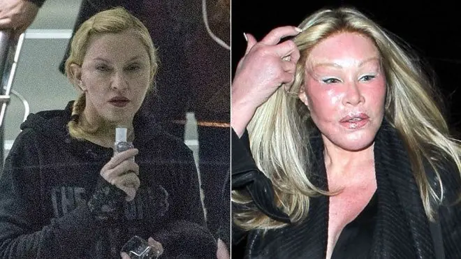 Las cirugías que espantaron a Hollywood