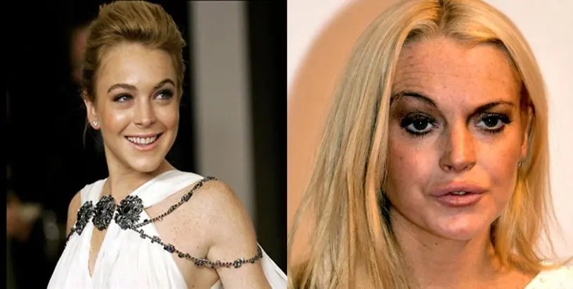 Las cirugías que espantaron a Hollywood