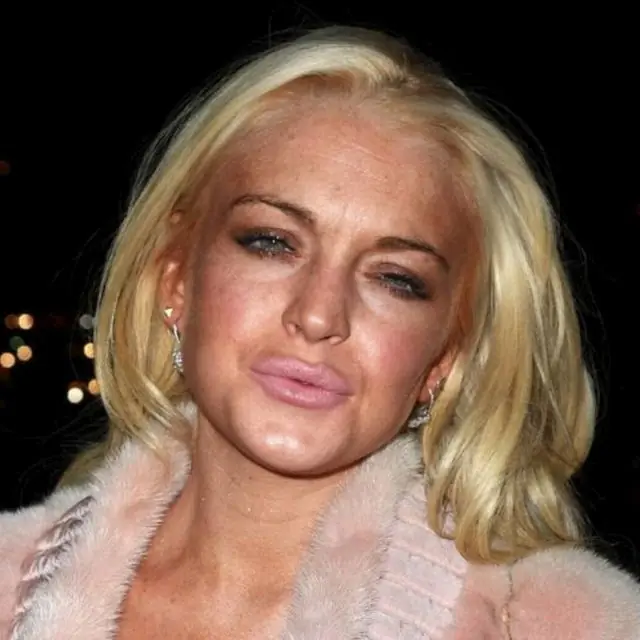 Las cirugías que espantaron a Hollywood