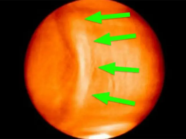Una enorme anomalía en Venus