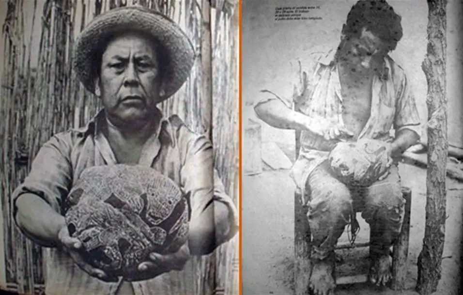 historia