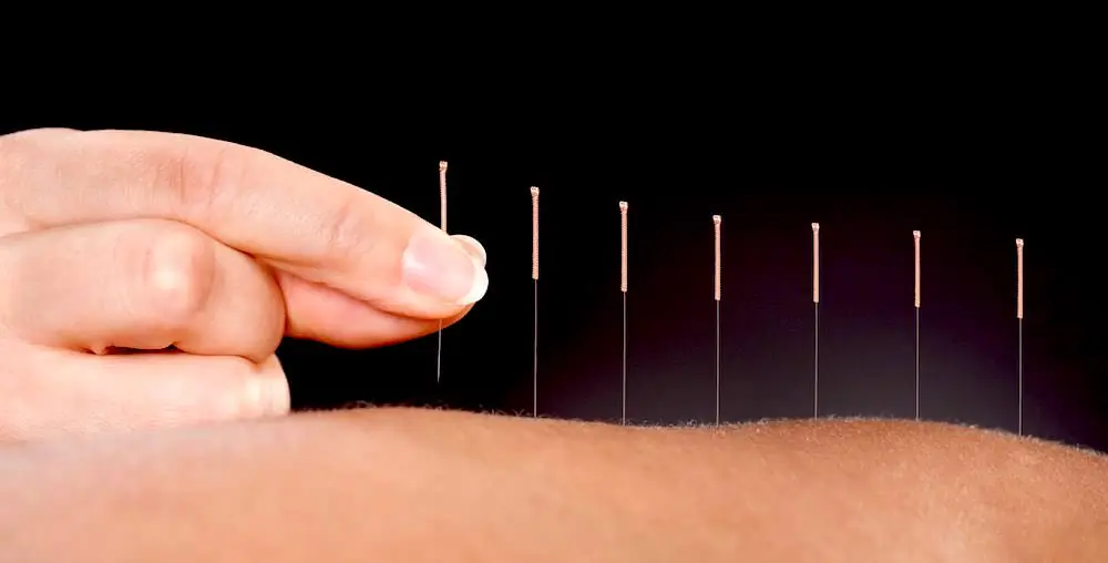 Explicación científica del funcionamiento de la acupuntura