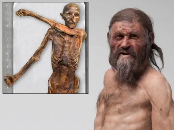 Oetzi, el Hombre de Hielo hallado en 1991 Oetzi, el Hombre de Hielo hallado en 1991