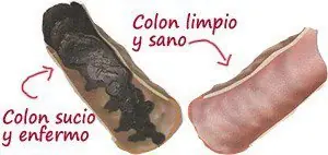 Como Limpiar Tu Colon Libera 4 Kilos de Desechos En 5 Dias