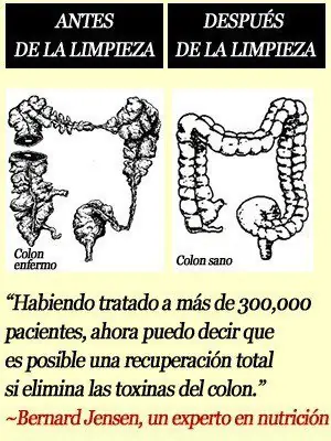 elimina elimina