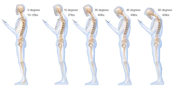 cervical cervical