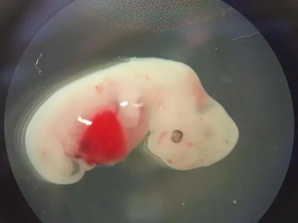 Crean en un laboratorio el primer híbrido humano-cerdo
