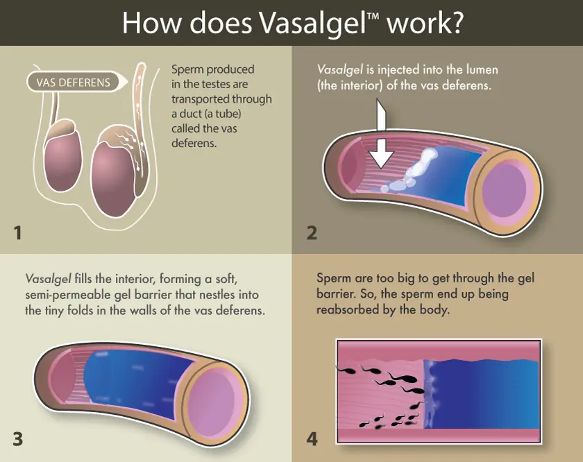 Nuevo método anticonceptivo masculino "Vasalgel" muy cerca