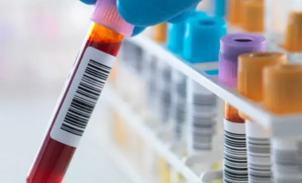 Informacion interesante de la sangre que tal vez no sabias Informacion interesante de la sangre que tal vez no sabias