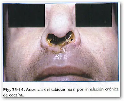 Cocaina