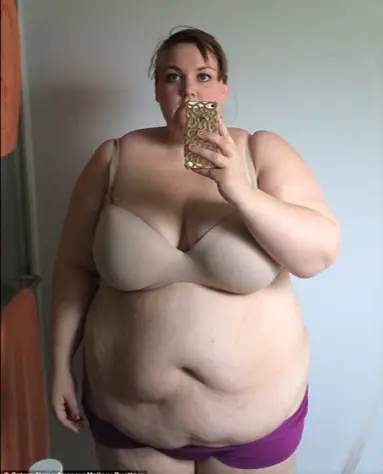 Perdió 100 kilos para cumplir su sueño de posar en bikini