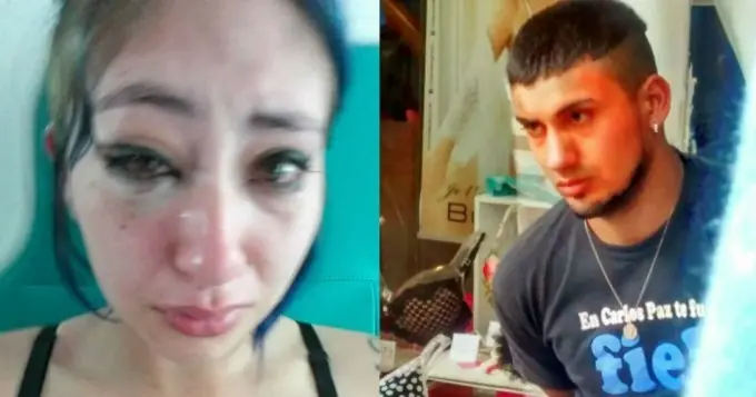 Se defendió de acosador y recibió brutal golpiza